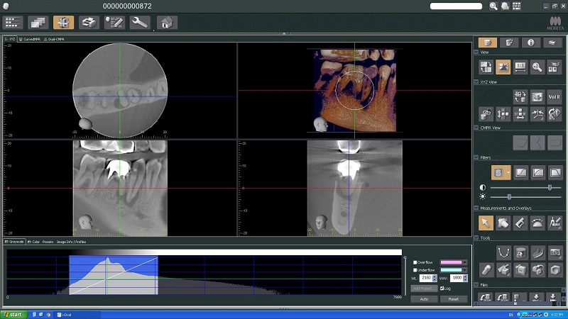Tomografii Computerizate 3D